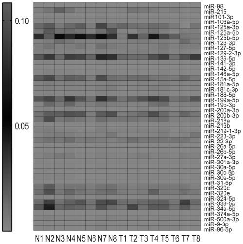 Hepatoma diagnosis kit for detecting microRNA expression level and application thereof