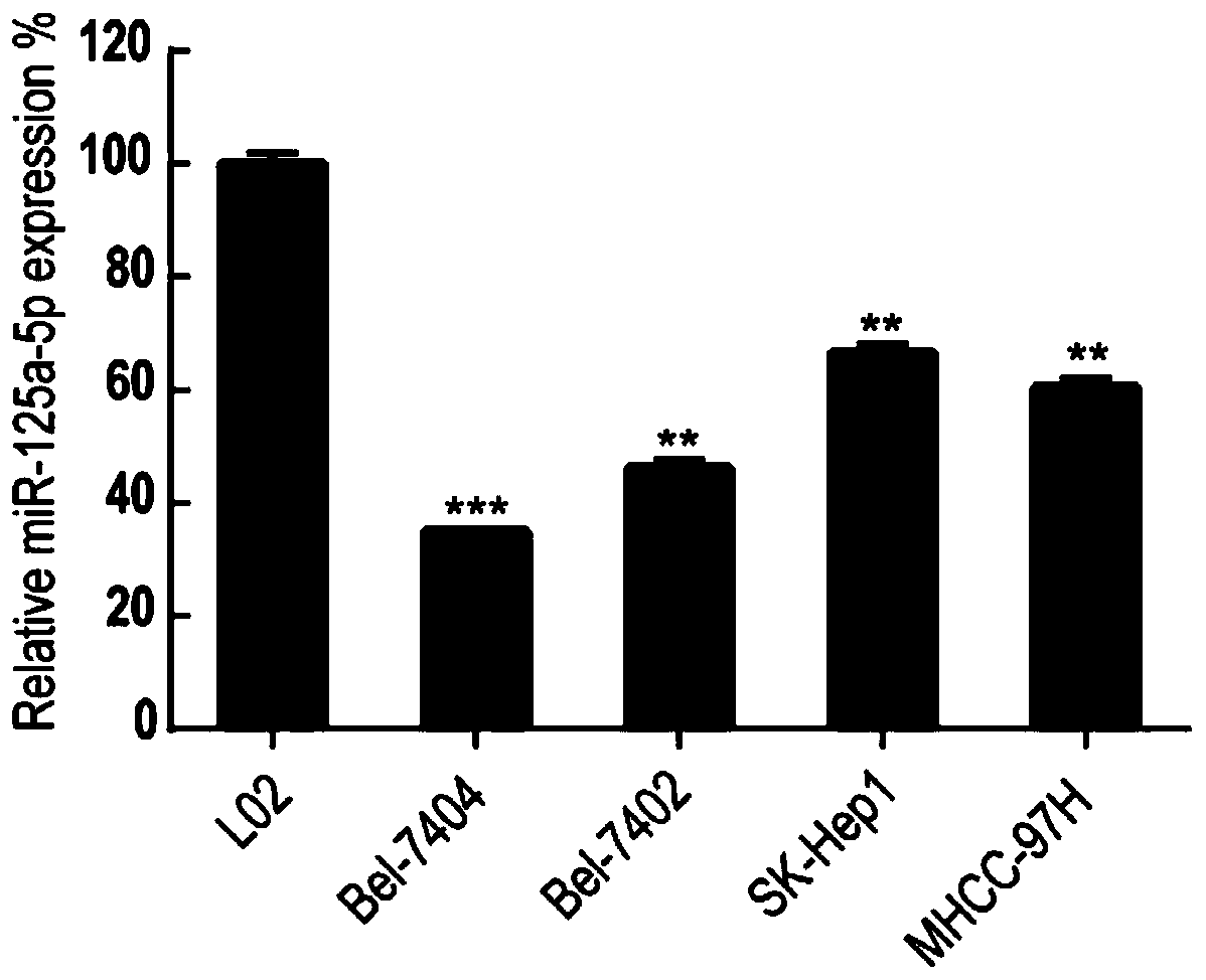 Hepatoma diagnosis kit for detecting microRNA expression level and application thereof