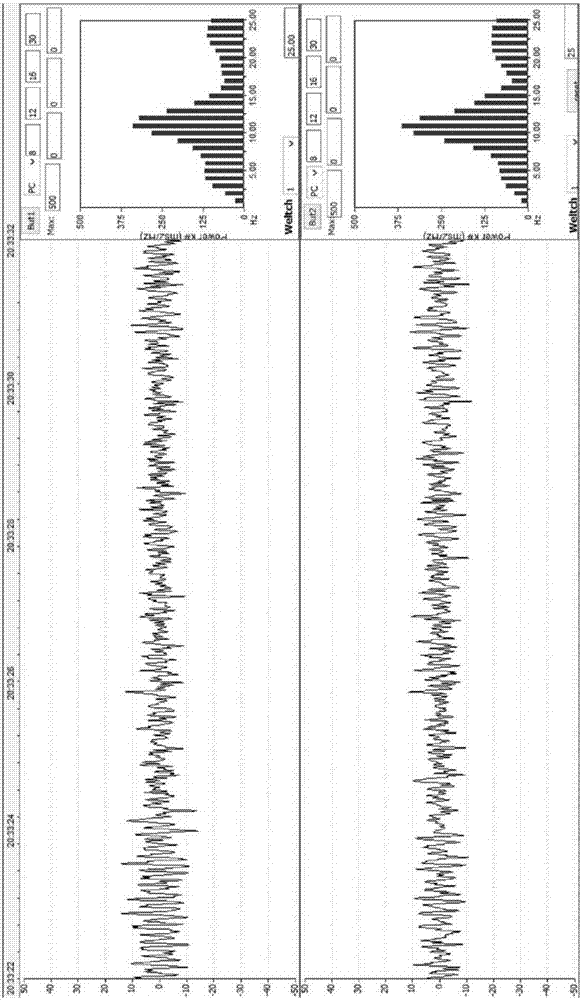 Spectacle type brain activity sensor and spectacle type electrophysiological activity sensing device