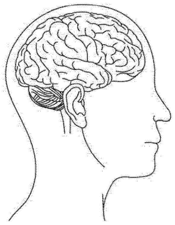 Spectacle type brain activity sensor and spectacle type electrophysiological activity sensing device