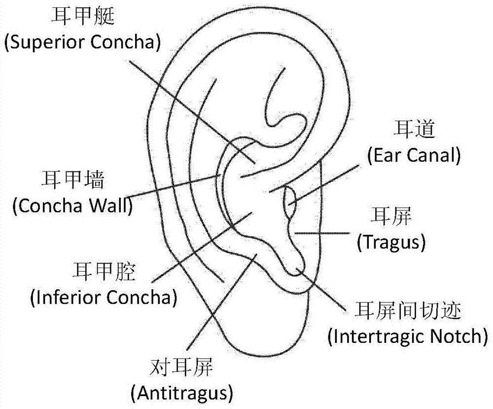 Spectacle type brain activity sensor and spectacle type electrophysiological activity sensing device