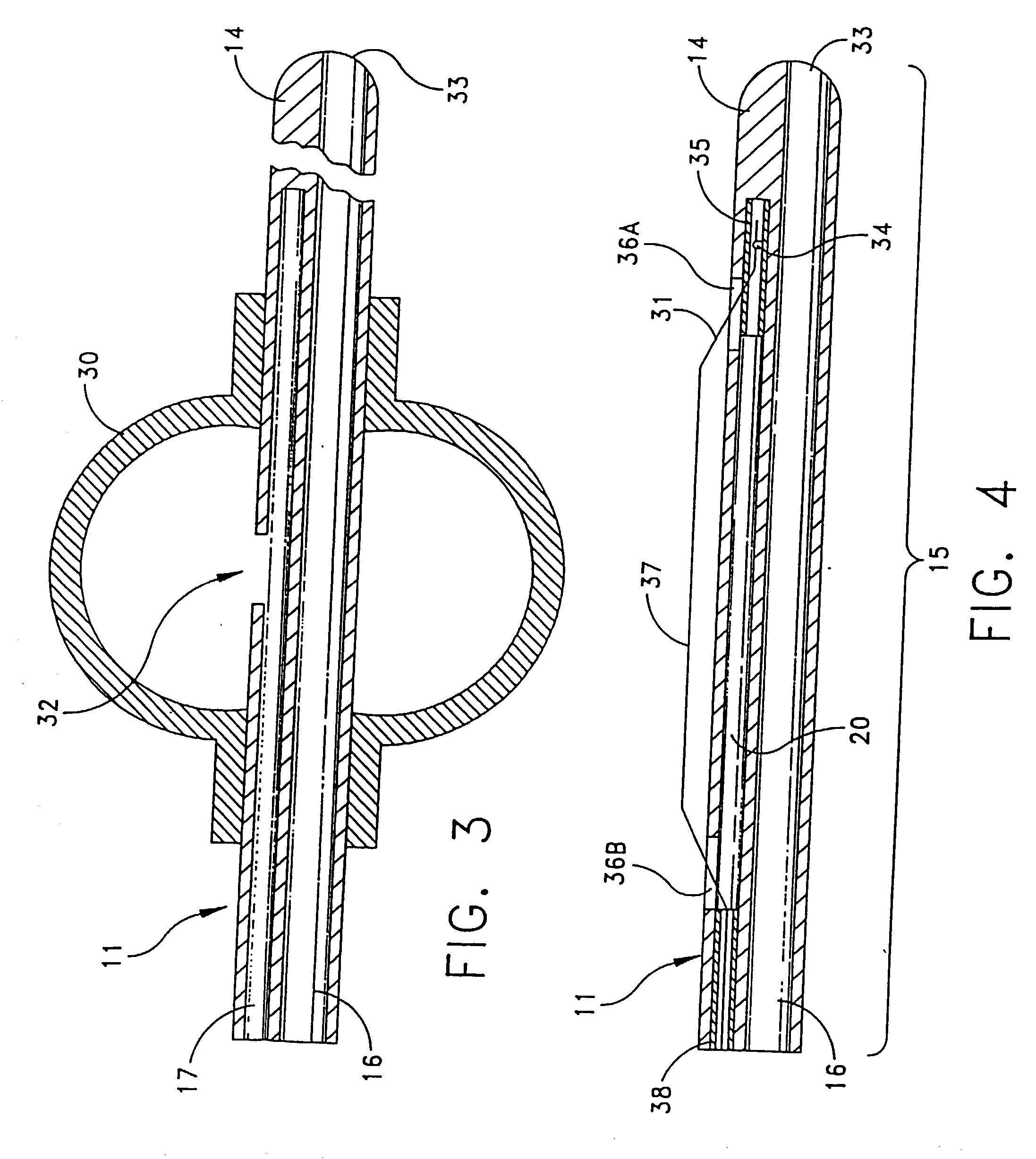 Apparatus for performing diagnostic and therapeutic modalities in the biliary tree