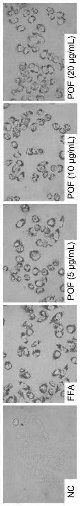 Application of fructus polygoni orientalis extract in preparation of drugs for preventing or treating non-alcoholic fatty liver diseases