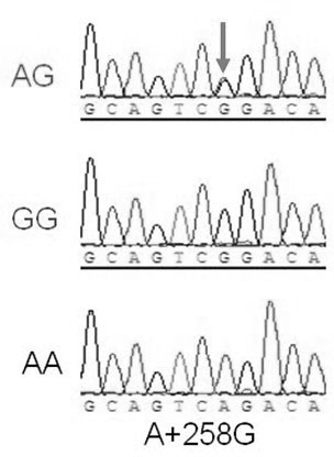 Heat resistance associated molecular marker on chicken heat stress protein 70 gene and acquiring method and application thereof