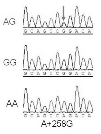 Heat resistance associated molecular marker on chicken heat stress protein 70 gene and acquiring method and application thereof