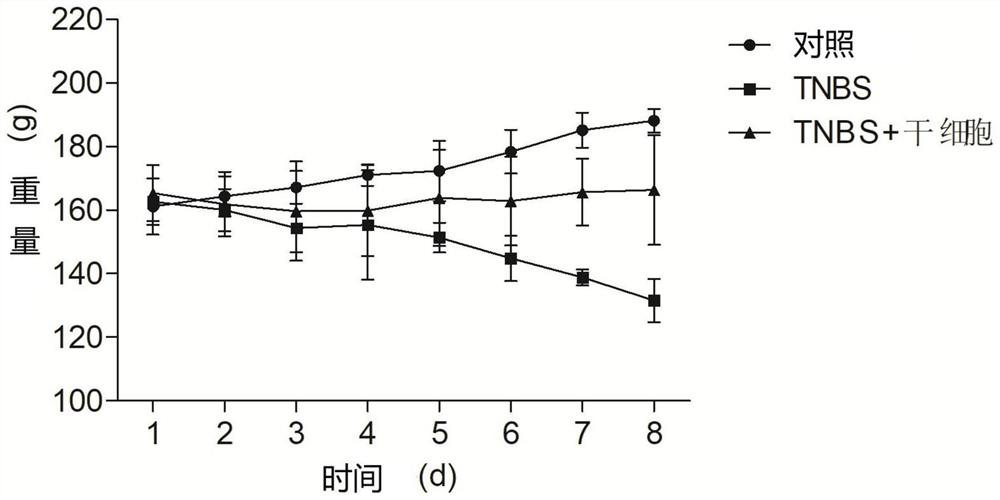 Pharmaceutical composition for treating Crohn's disease and preparation method thereof