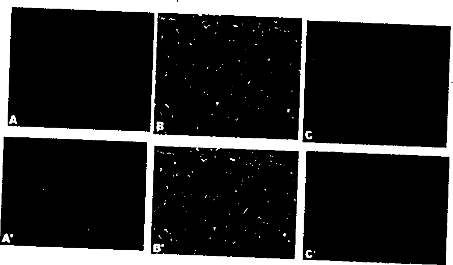 Process for screening active components playing weight losing and hypolipemic role from Chinese-herbal medicines