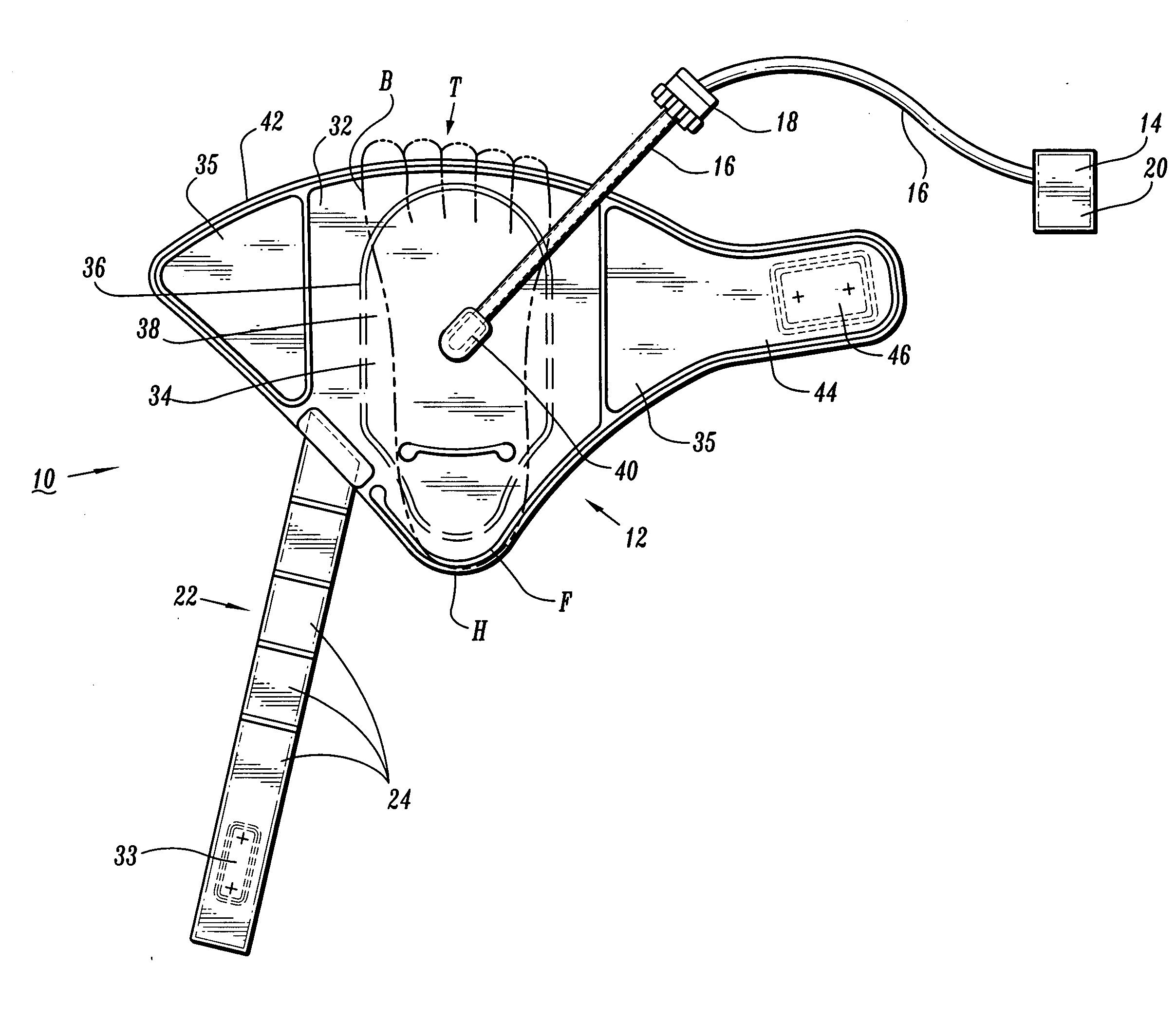 Compression apparatus