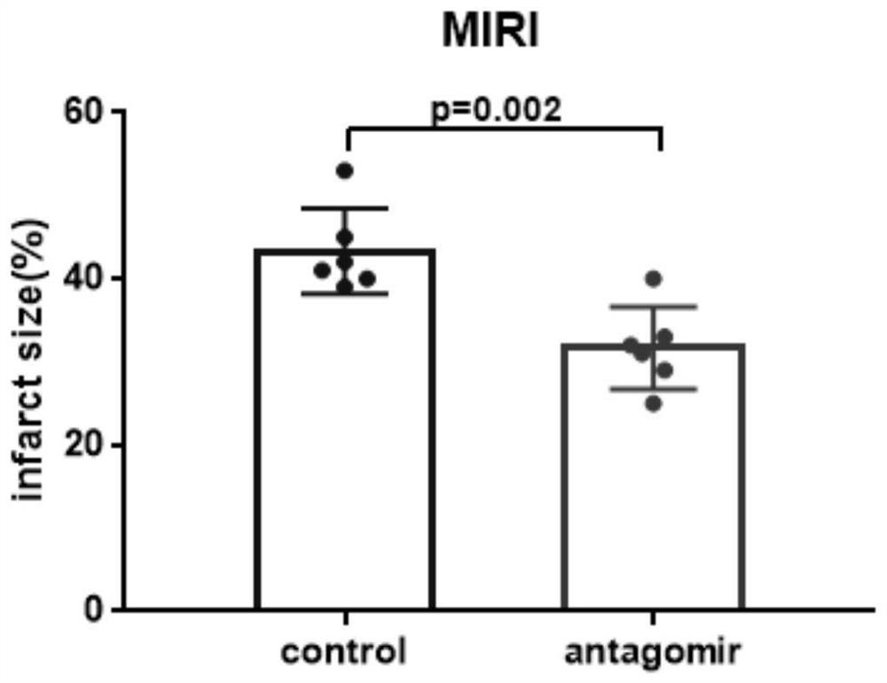 Application of miR-208a-3p antisense nucleic acid in treatment of myocardial ischemia reperfusion injury