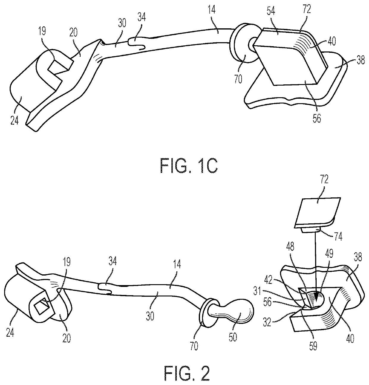 Orthopedic-orthodontic molar distalizer