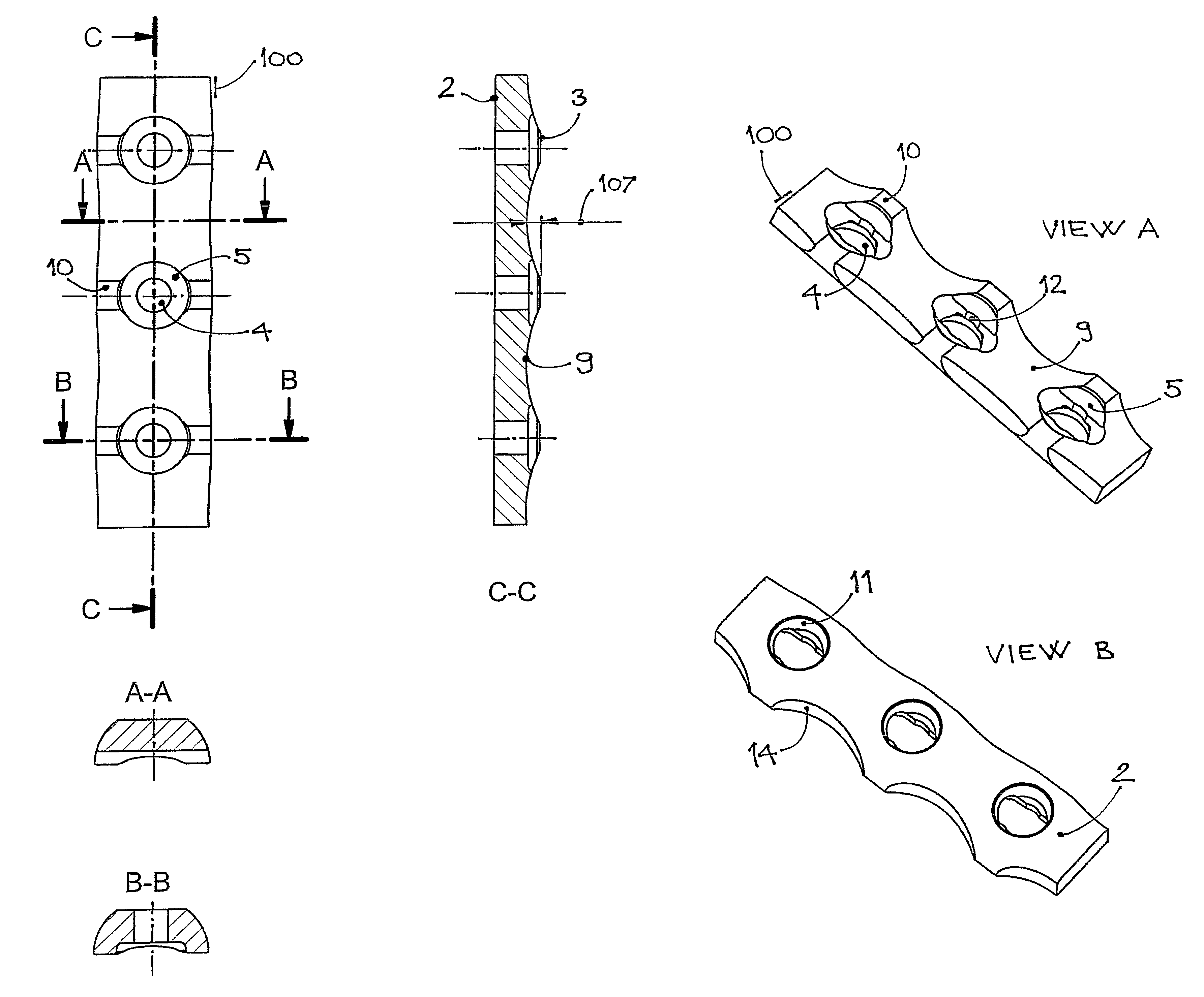 Plate and screws for treatment of bone fractures