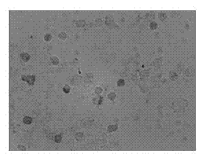 In-situ hybridization screening kit for mRNA (messenger Ribonucleic Acid) level of gene CD33 of prophase lesion of Alzheimer's disease (AD) and screening method and application thereof