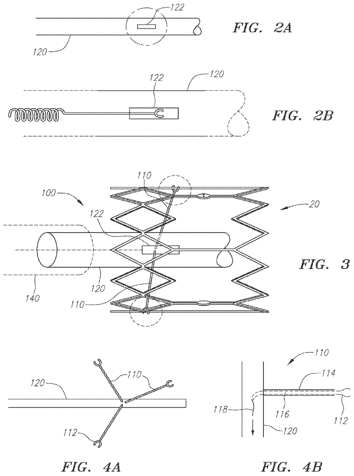 Percutaneous heart valve delivery systems