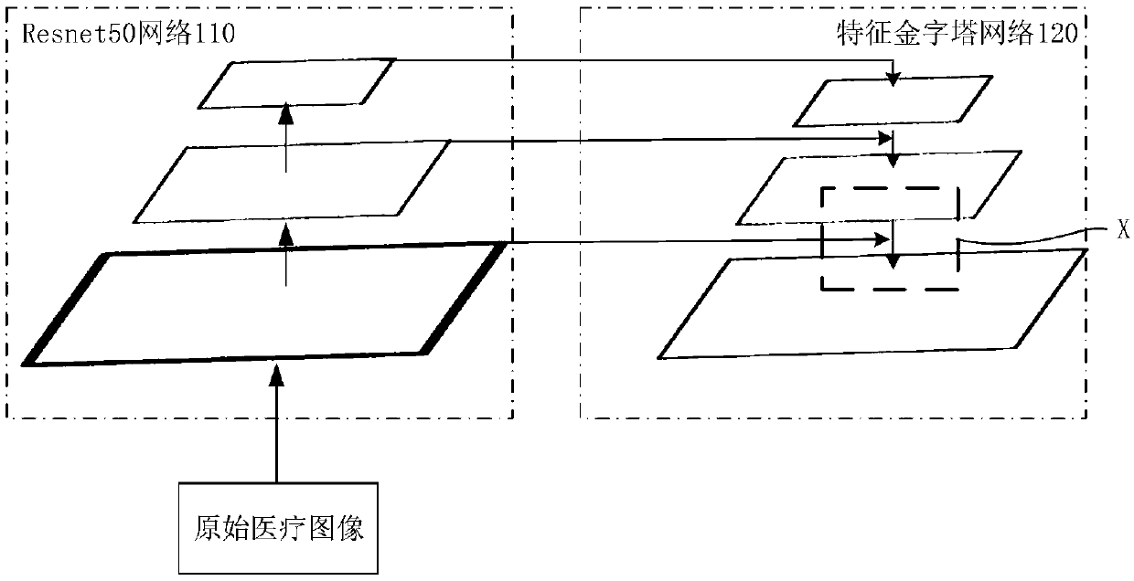 A medical image segmentation method