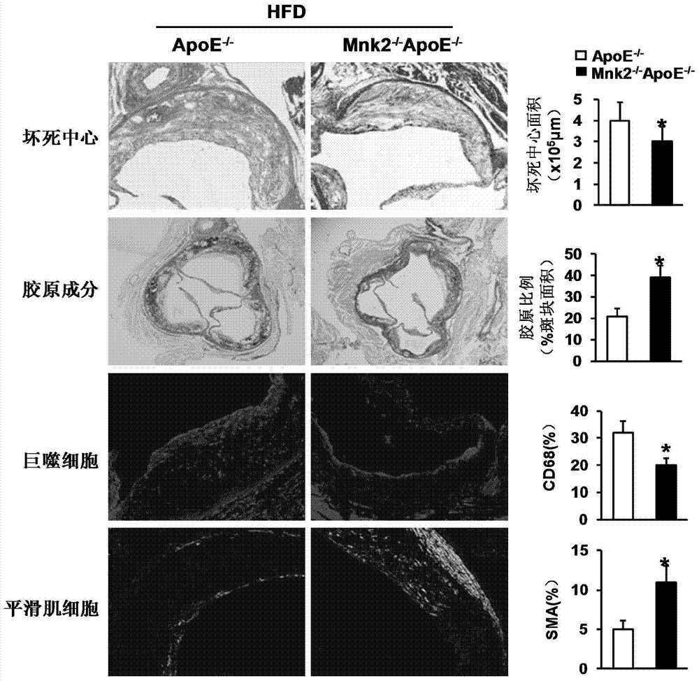 Function and application of MAPK (mitogen-activated protein kinase) signal-integrating kinase 2 in treatment of atherosclerosis