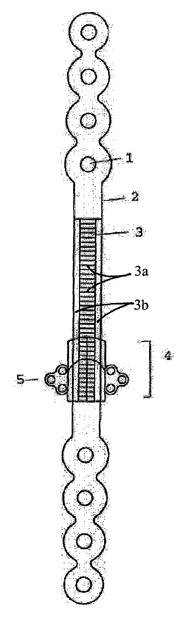 Mandibular bone transport reconstruction plate