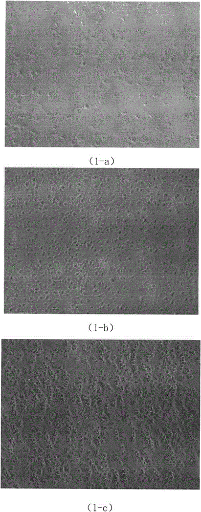 Method for inducing human neural stem cells to differentiate into dopaminergic neurons in vitro