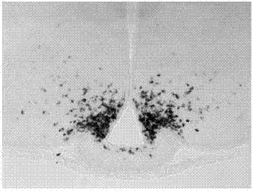 cRNA (complementary ribonucleic acid) in situ hybridization probe of neuropeptide Y and preparation method of cRNA in situ hybridization probe