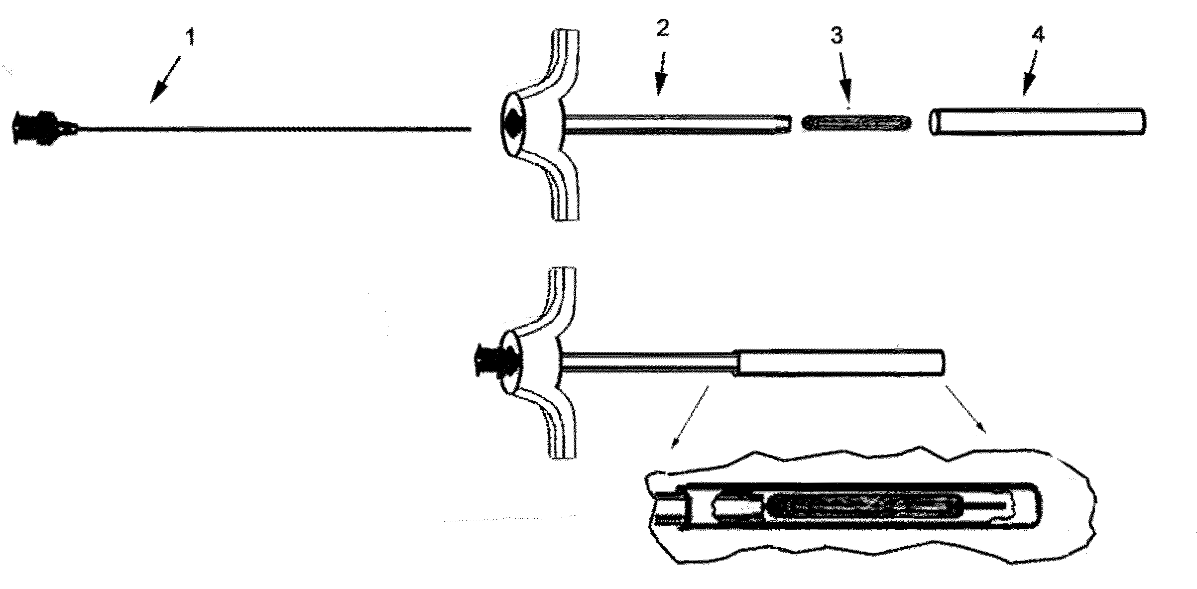 Therapeutic material delivery system for tissue voids and cannulated implants