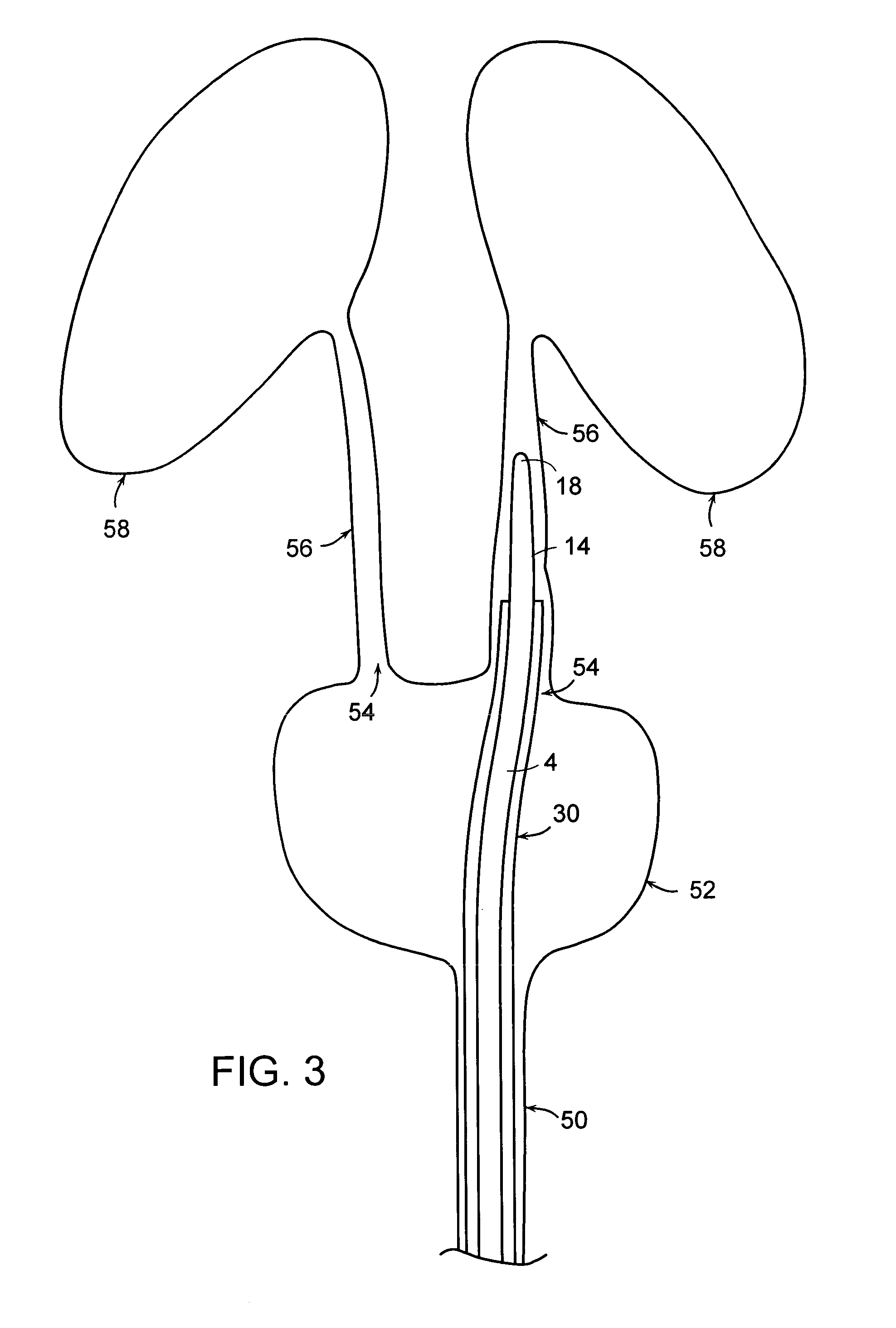 Dilator with expandable member