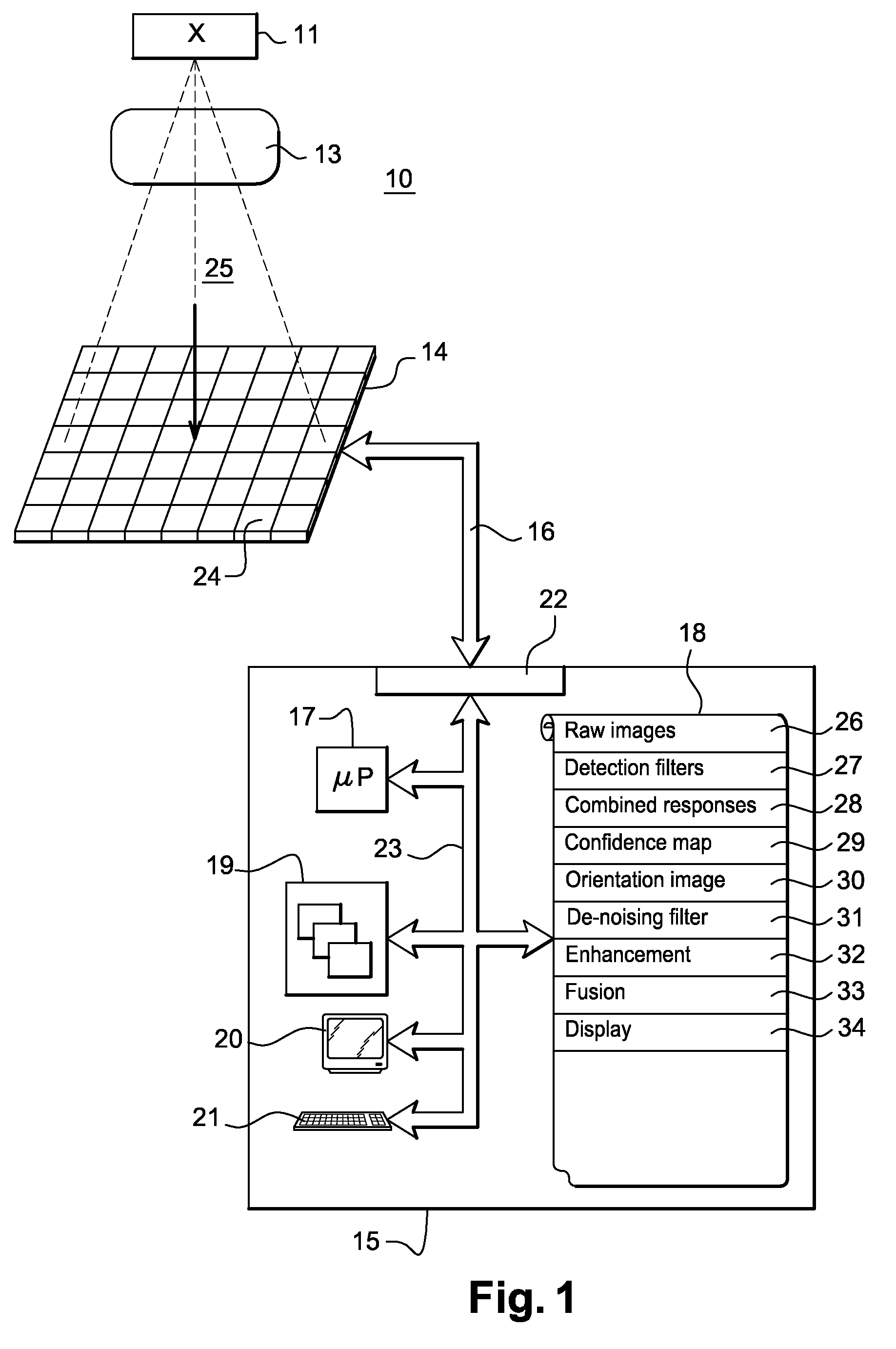 Method for the processing of images in interventional radioscopy