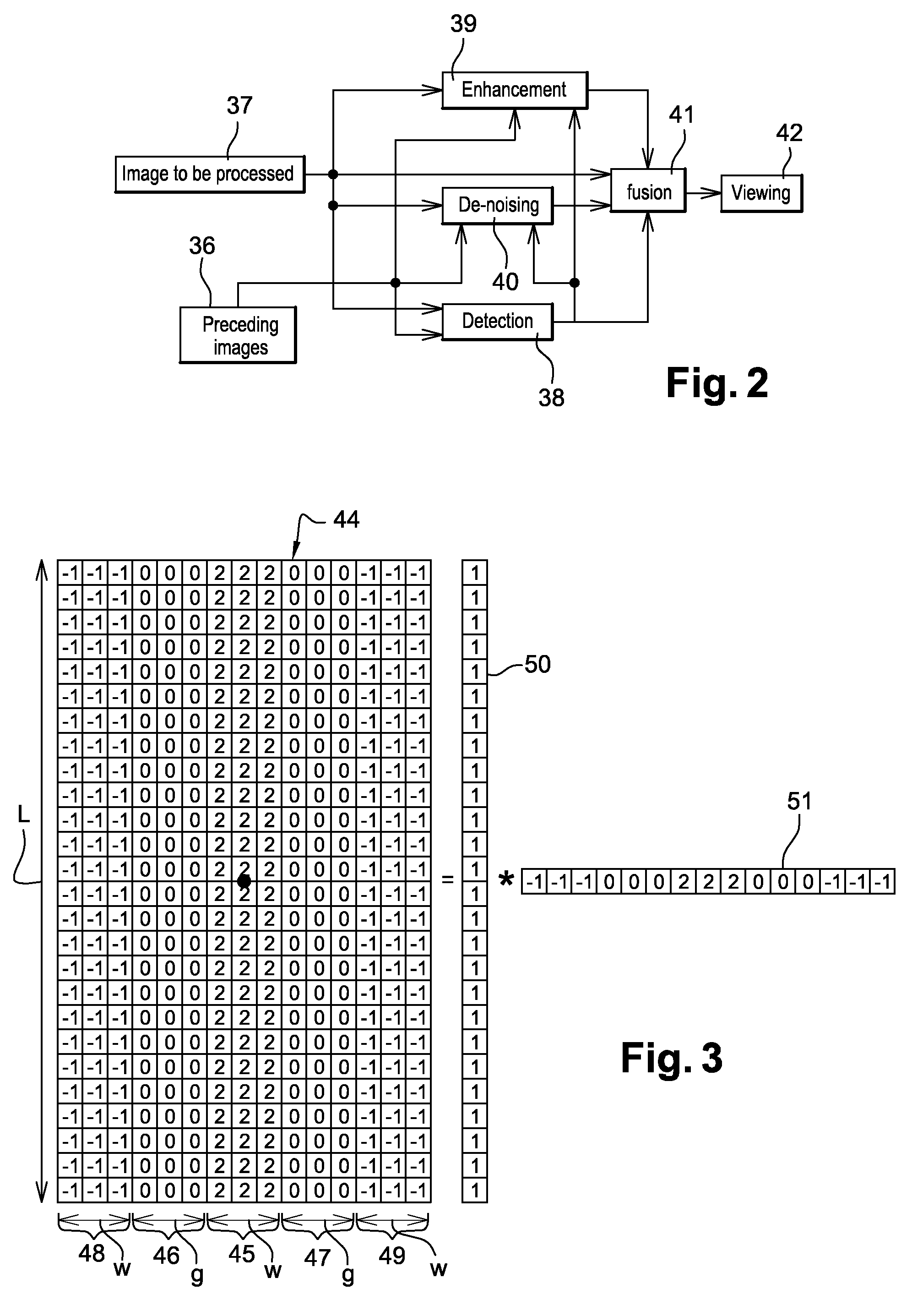 Method for the processing of images in interventional radioscopy