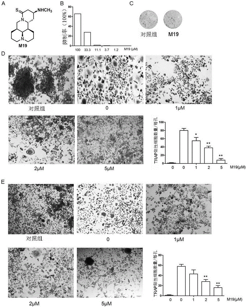 Application of matrine derivatives in preparation of medicines for preventing or treating postmenopausal osteoporosis