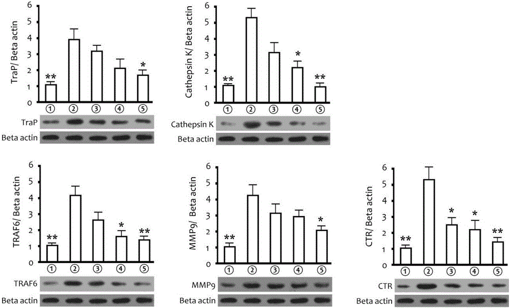 Application of matrine derivatives in preparation of medicines for preventing or treating postmenopausal osteoporosis