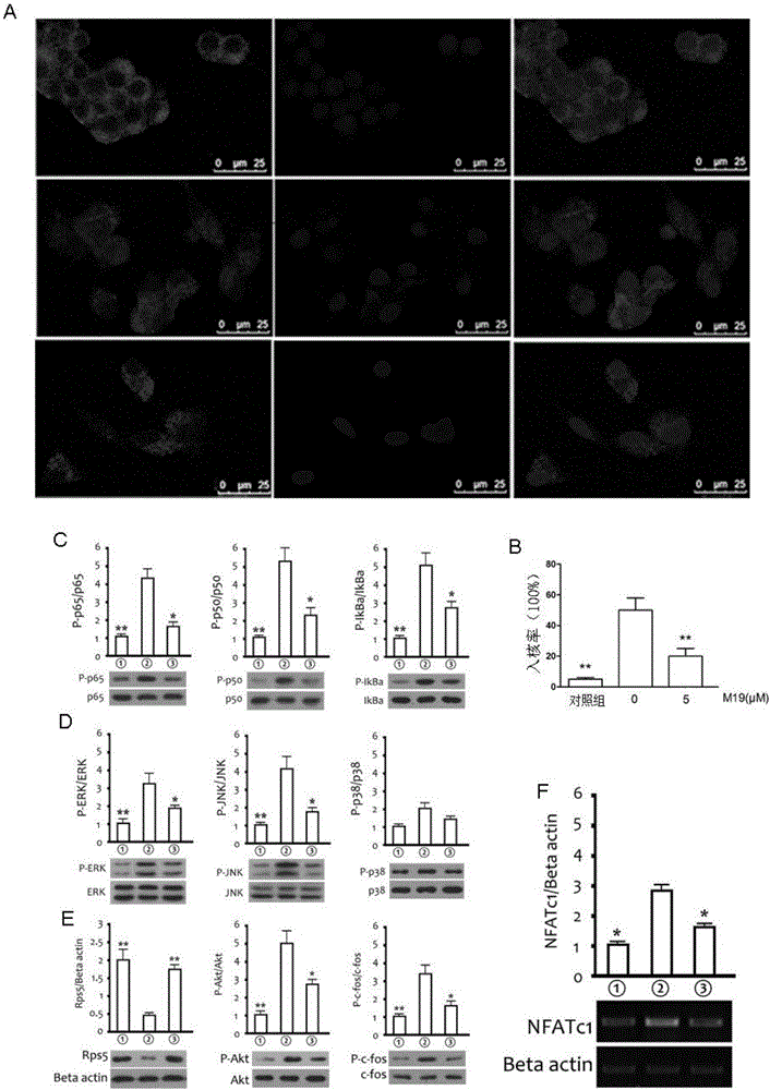 Application of matrine derivatives in preparation of medicines for preventing or treating postmenopausal osteoporosis