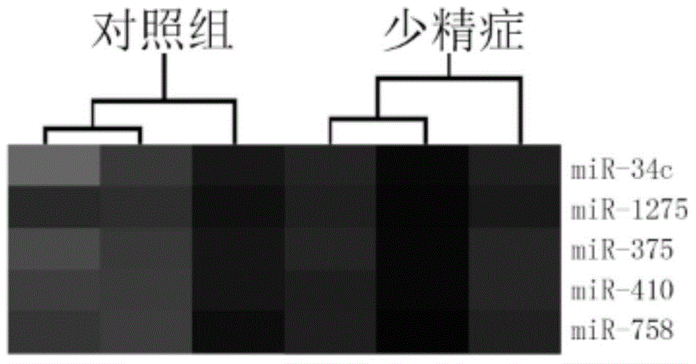 Serum miRNA biomarker composition and application thereof