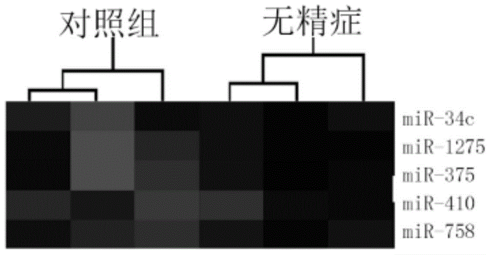 Serum miRNA biomarker composition and application thereof