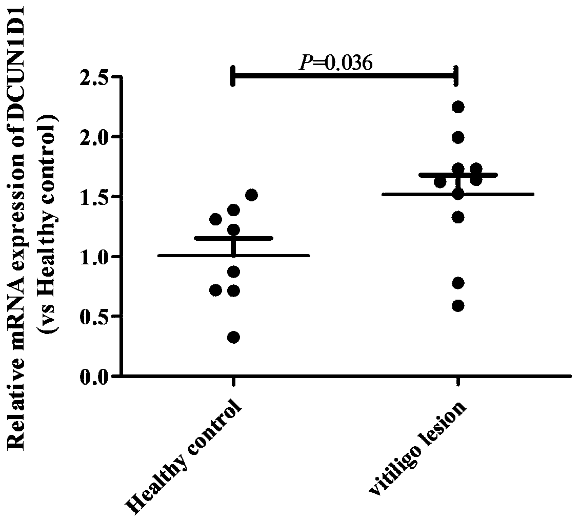 Application of DCUN1D1 gene to control of vitiligo