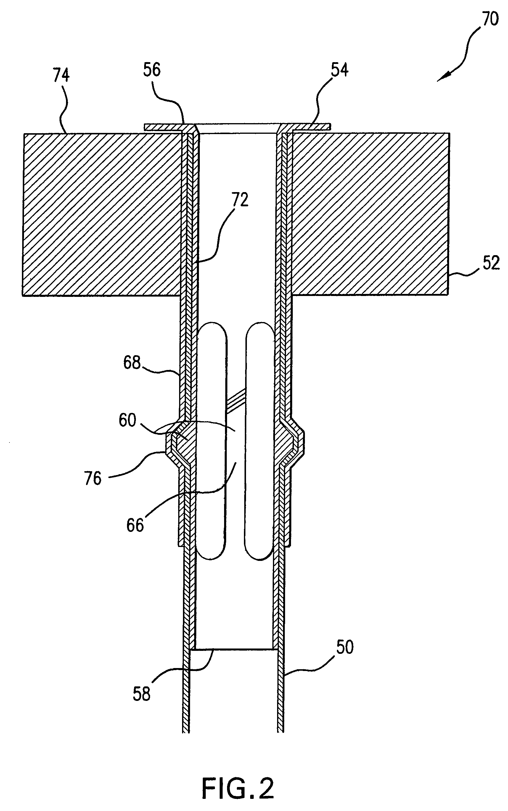 Fuel assembly top nozzle repair sleeve and method for repairing a fuel assembly