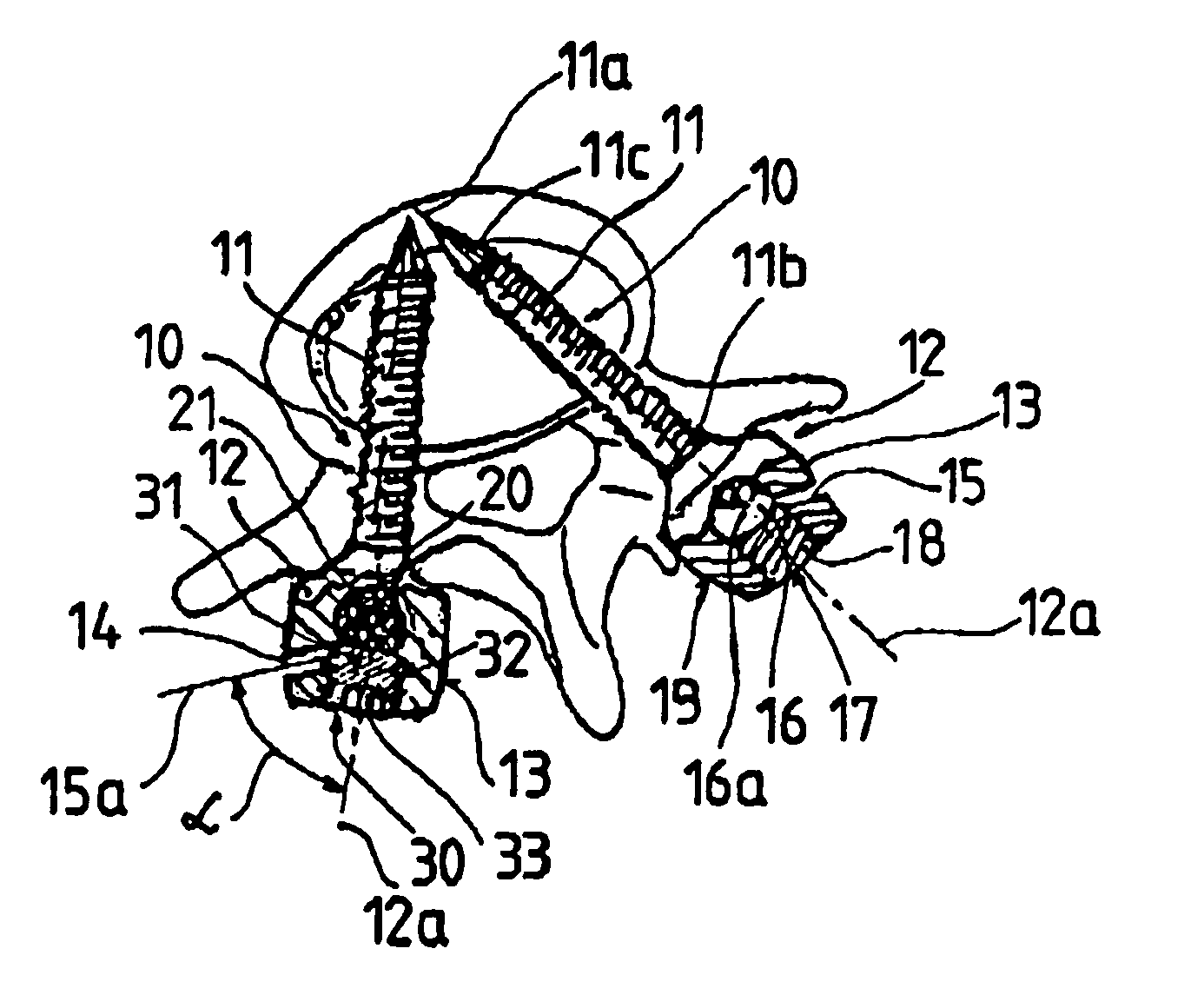 Set of surgical instruments for the fixation of vertebrae