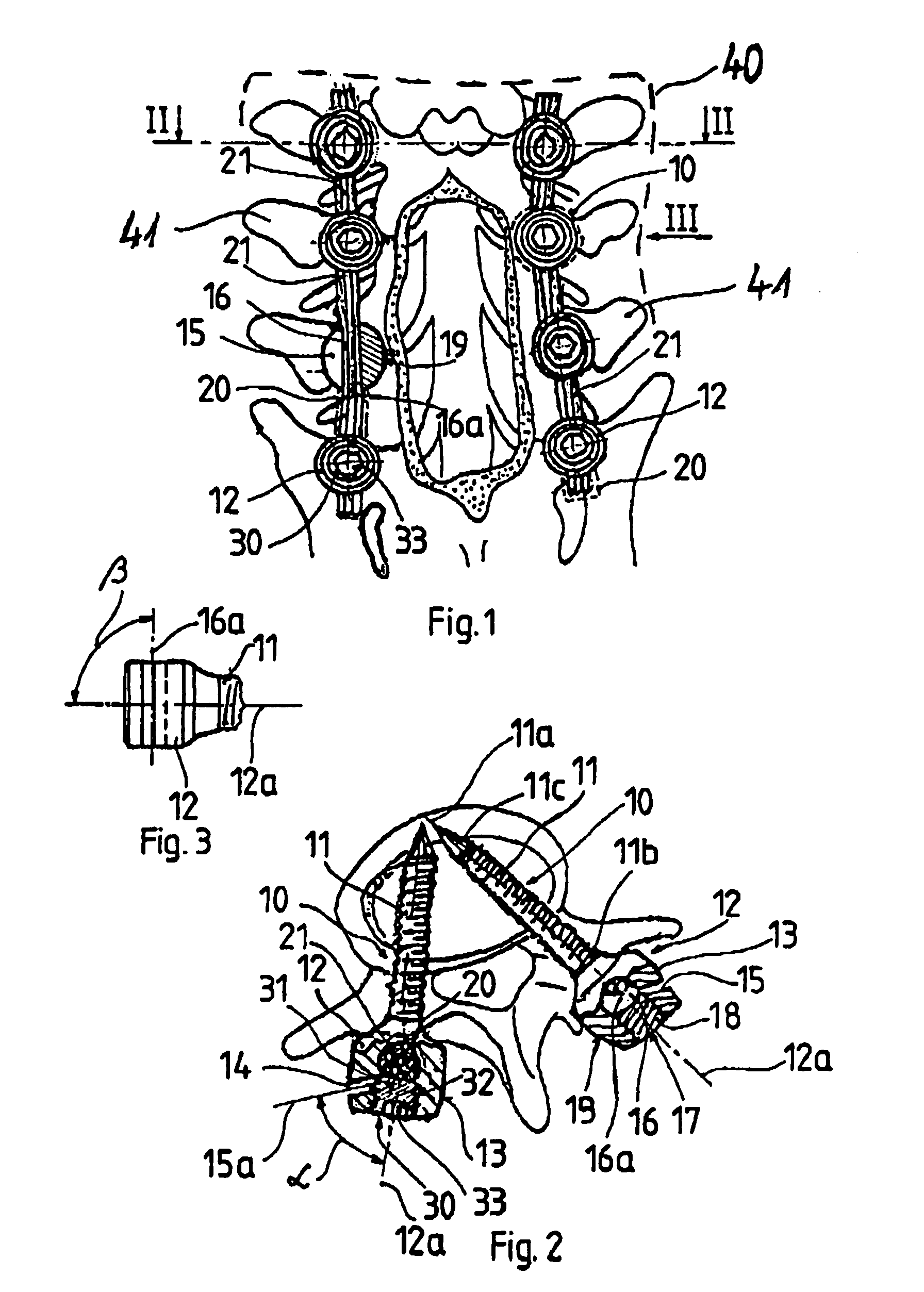 Set of surgical instruments for the fixation of vertebrae