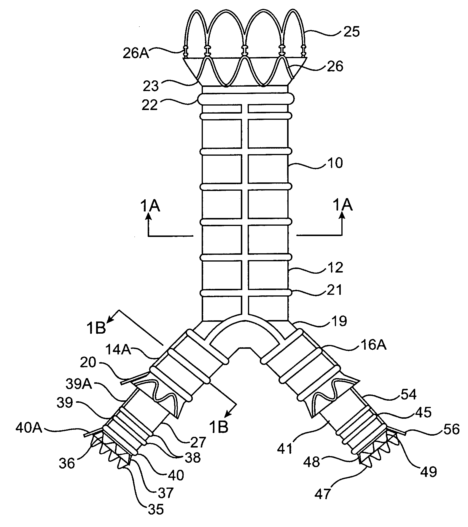 Modular endovascular graft