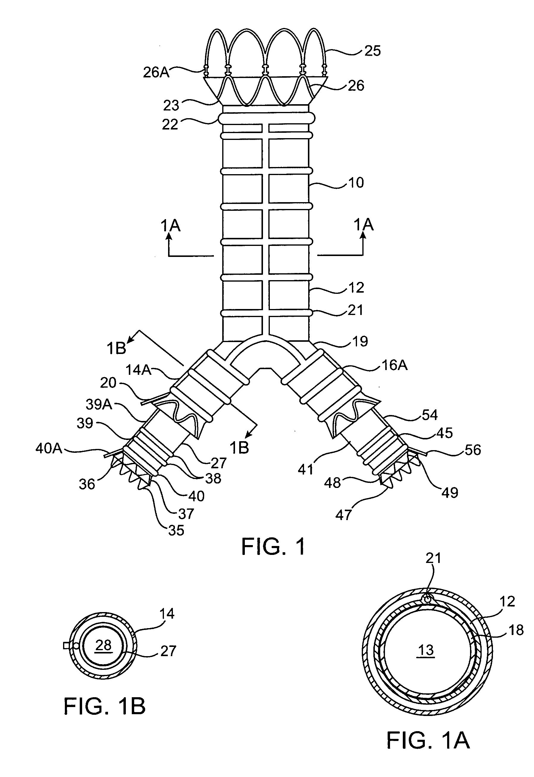 Modular endovascular graft