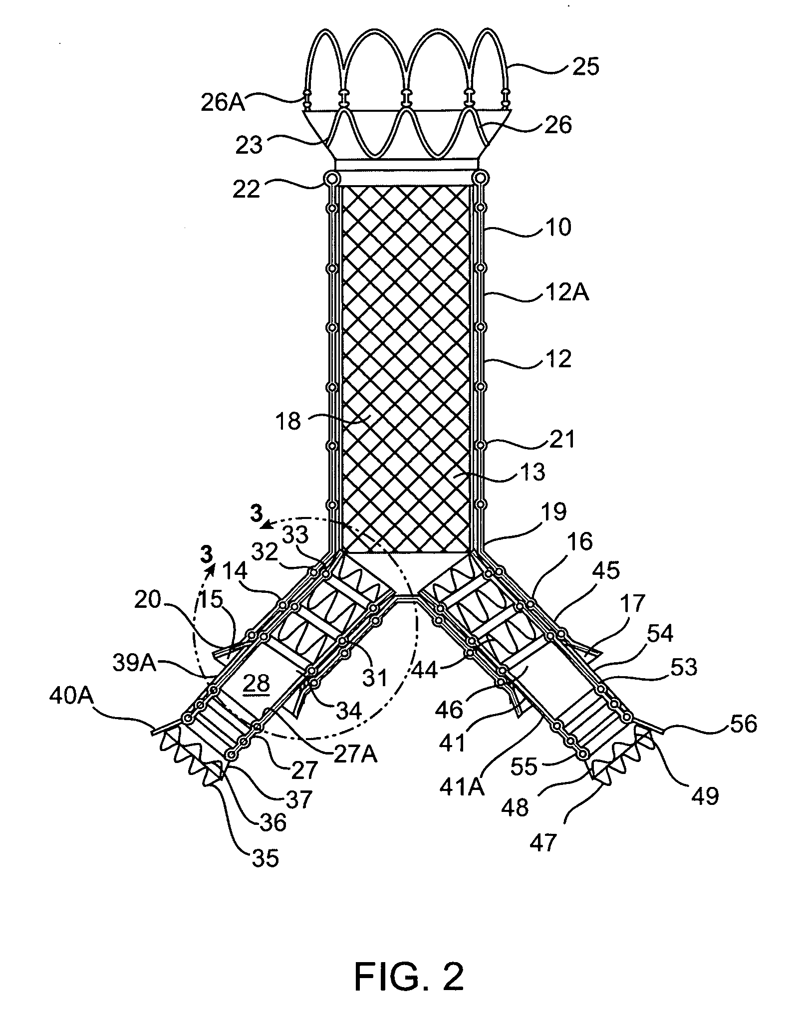 Modular endovascular graft