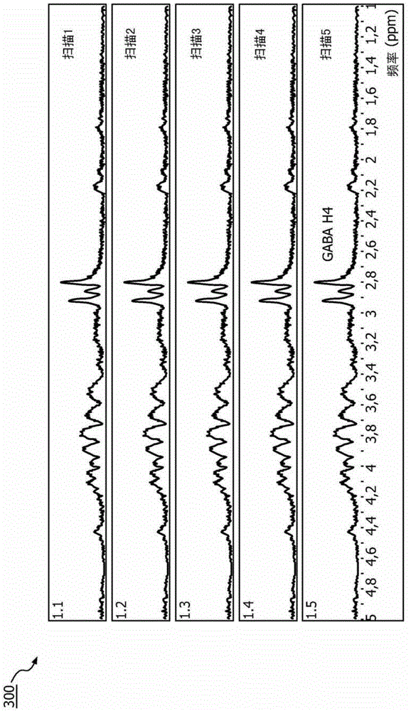 MR system and method for detecting metabolites