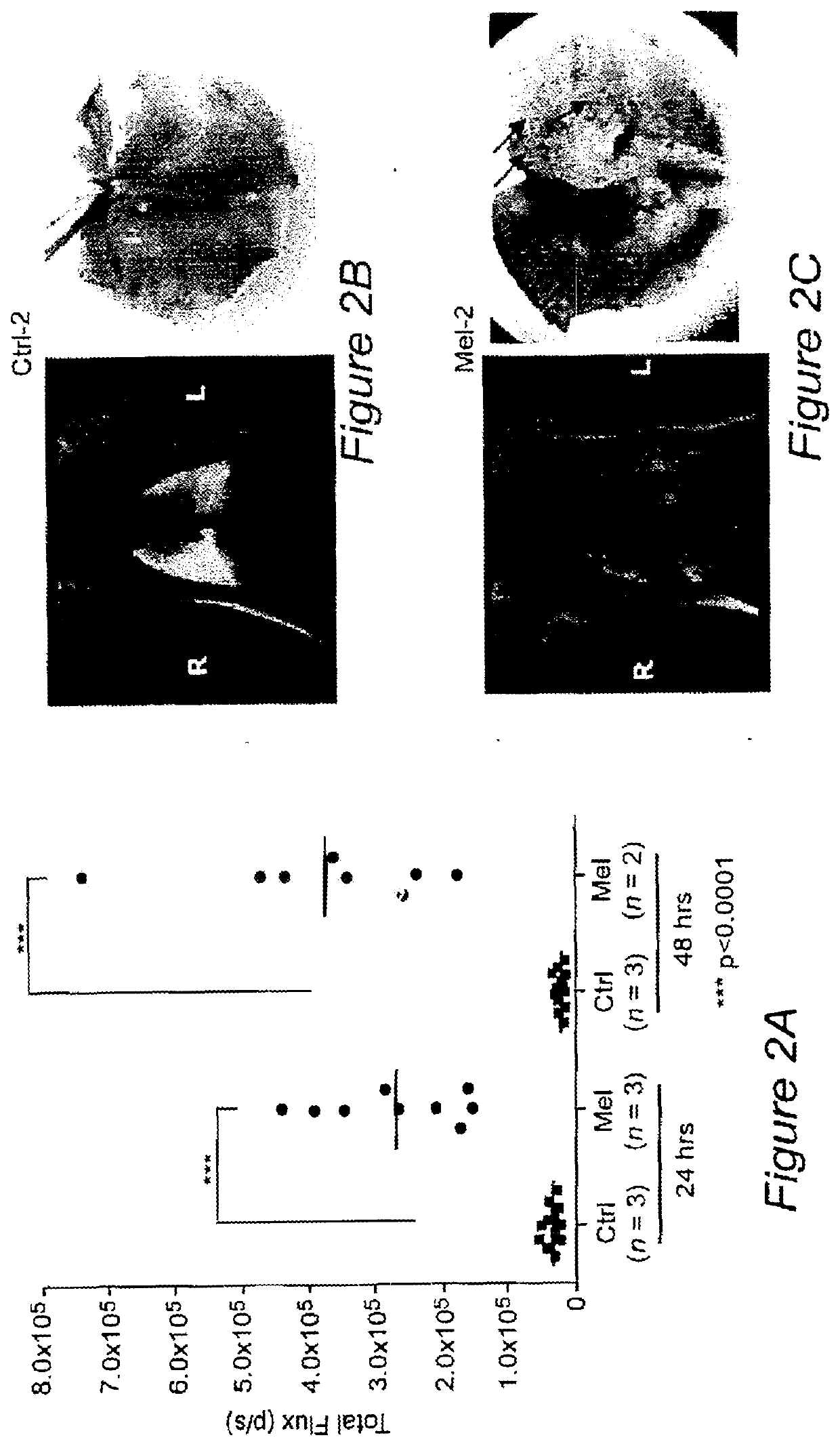 Cancer imaging with therapy: theranostics