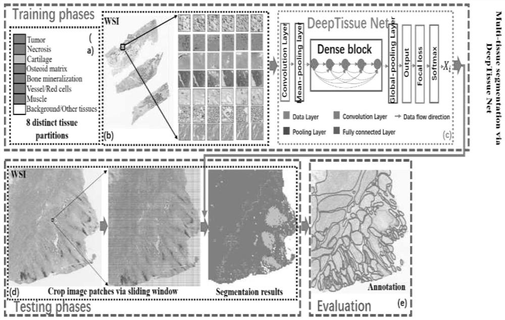 Osteosarcoma recurrence risk prediction model based on tissue morphological analysis