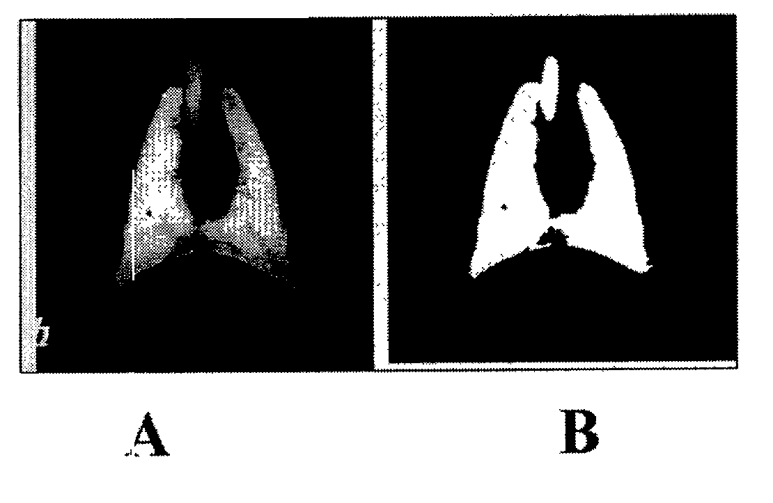 Equilibration method for high resolution imaging of lung compliance and distribution of functional residual capacity