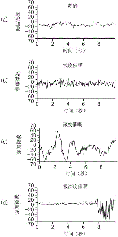 Method and apparatus for measuring anesthetic depth