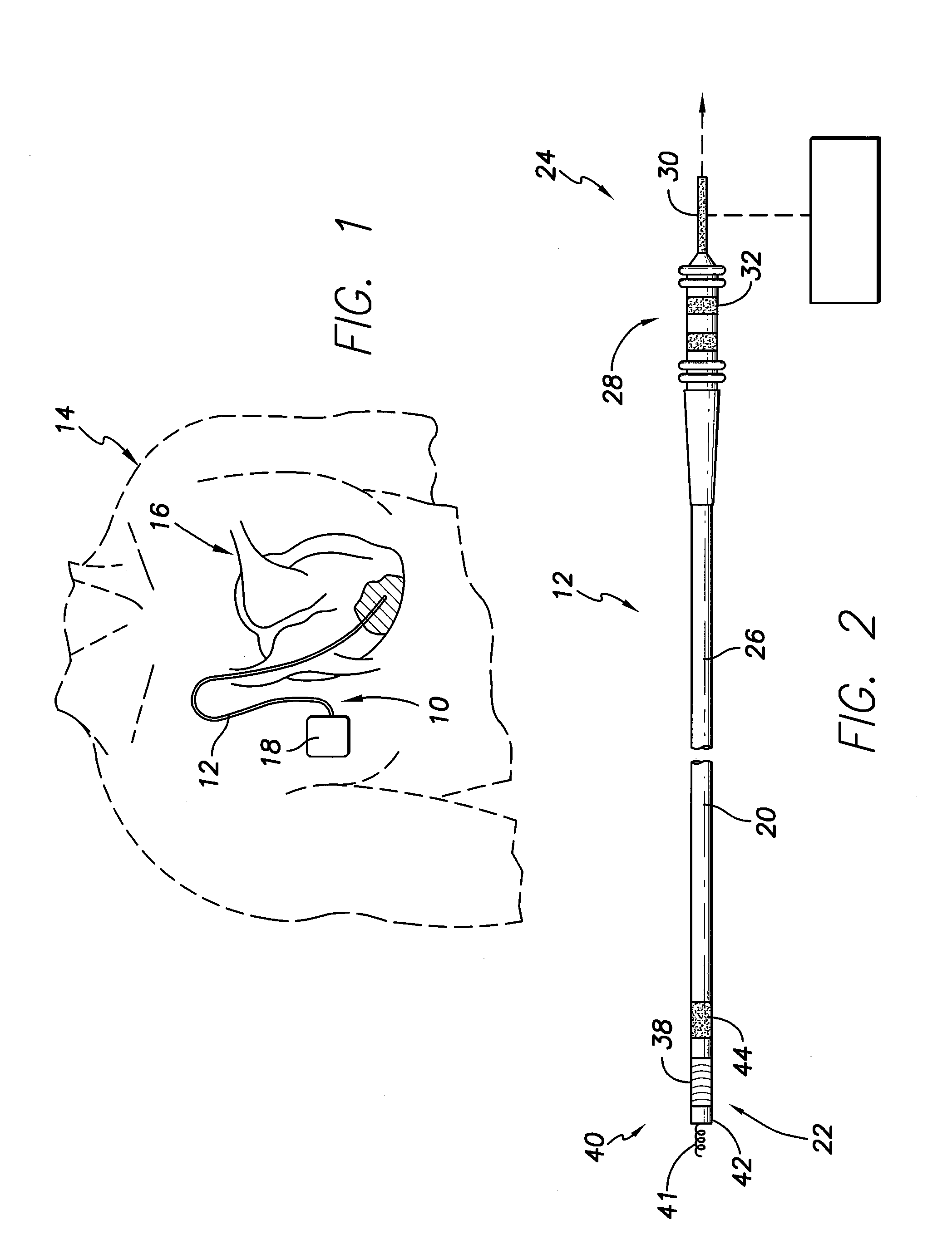 MRI compatible implantable lead