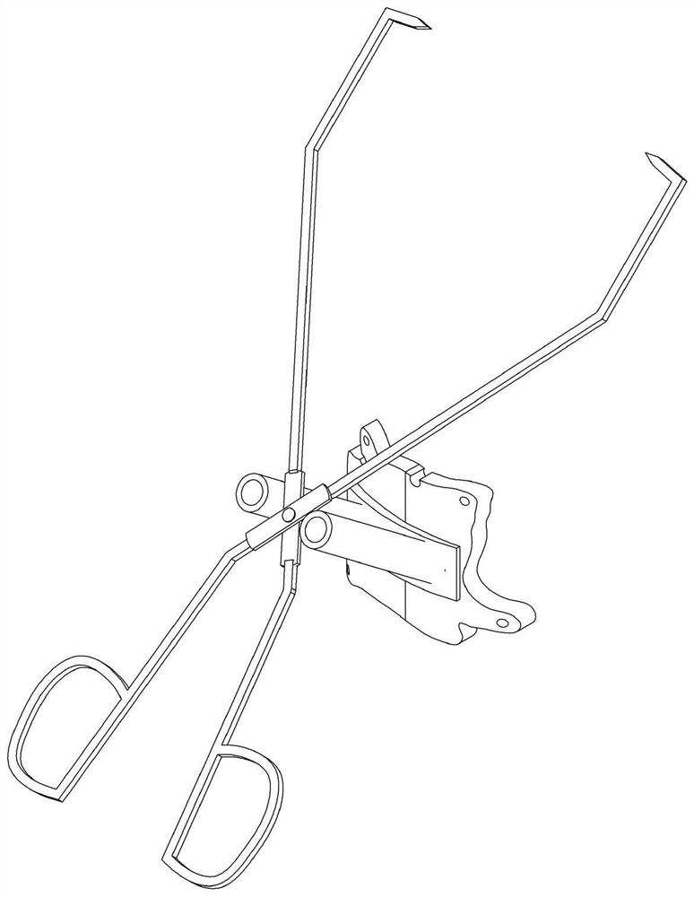 Anatomical biomechanical type 3D printing humerus greater tubercle cleavage fracture guider