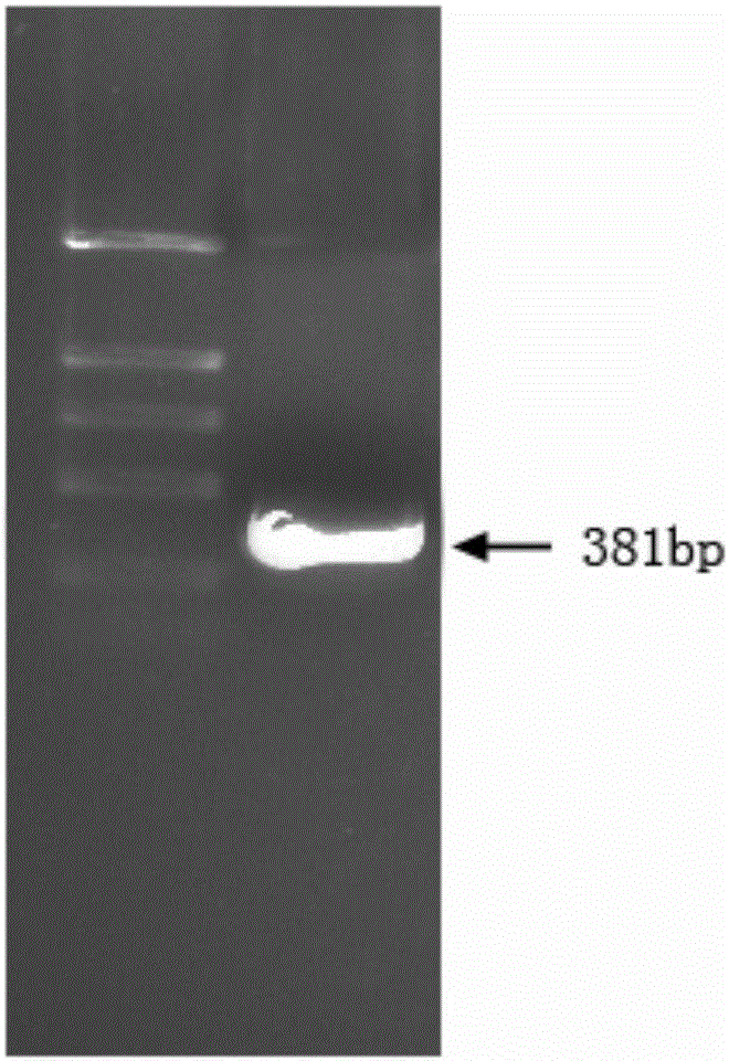 Cancer inhibition polypeptide 127aa and expression vector and application thereof