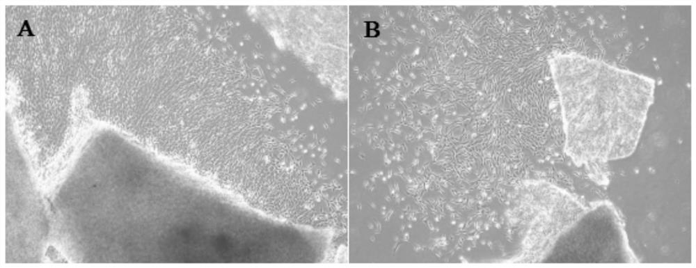 Application of antibody CD29 in identification and sorting of human-placenta-chorion-avillosum-derived mesenchymal stem cells