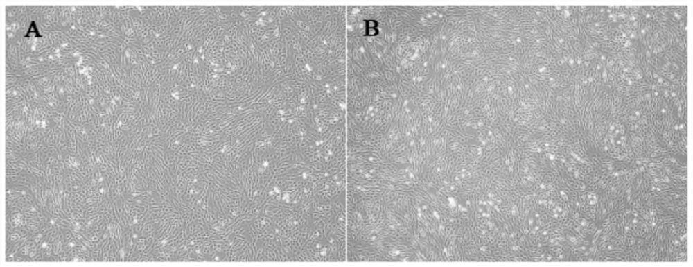 Application of antibody CD29 in identification and sorting of human-placenta-chorion-avillosum-derived mesenchymal stem cells