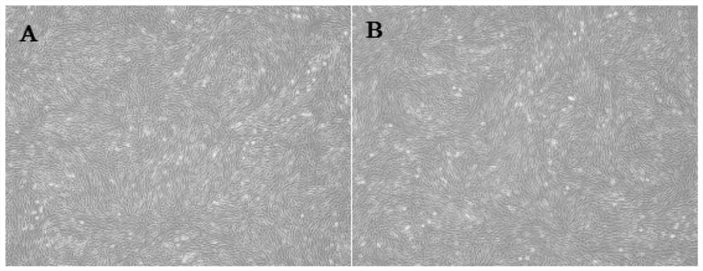 Application of antibody CD29 in identification and sorting of human-placenta-chorion-avillosum-derived mesenchymal stem cells