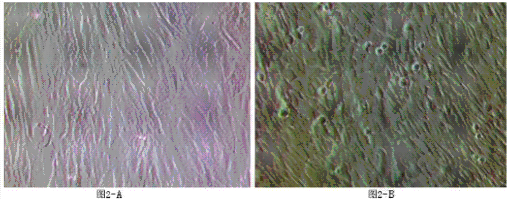 Culture method for fibroblast derived from autologous body skin